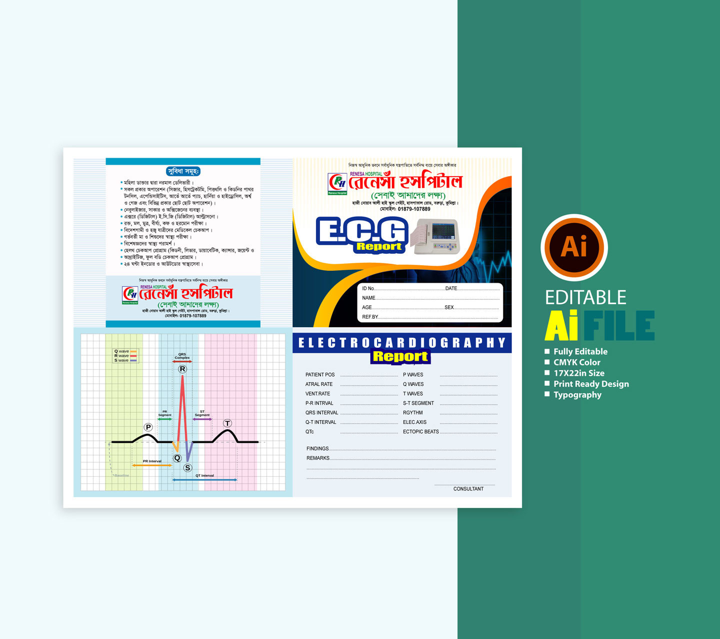 ইসিজি রিপোর্ট ফাইল- ECG report file